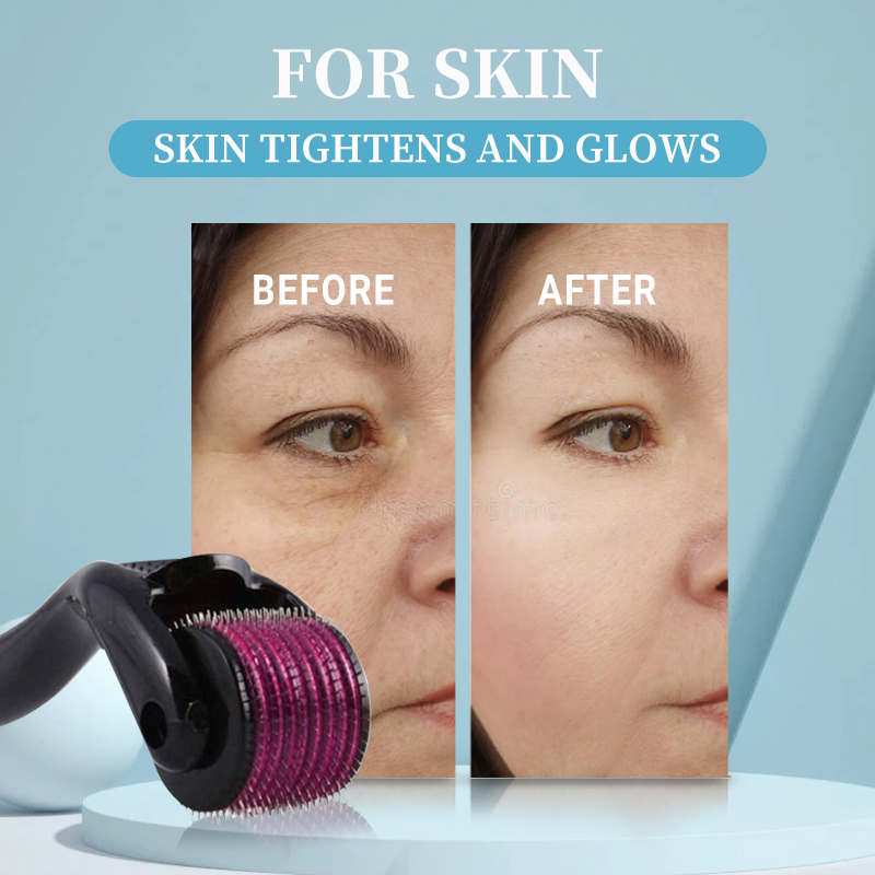 Professional 540 Roller Derma  – Derma Roller 0.25 Bewertung und Preis