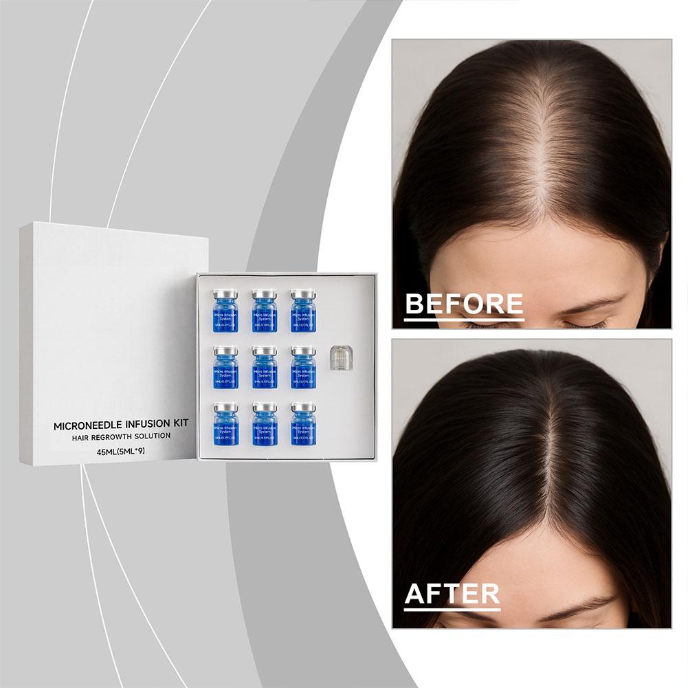 0.25mm Hair Essential Serum Mi – Derma Roller 0.25 Bewertung und Preis
